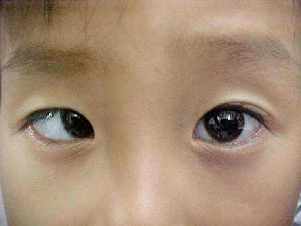PedsCases | Pediatric Education Online